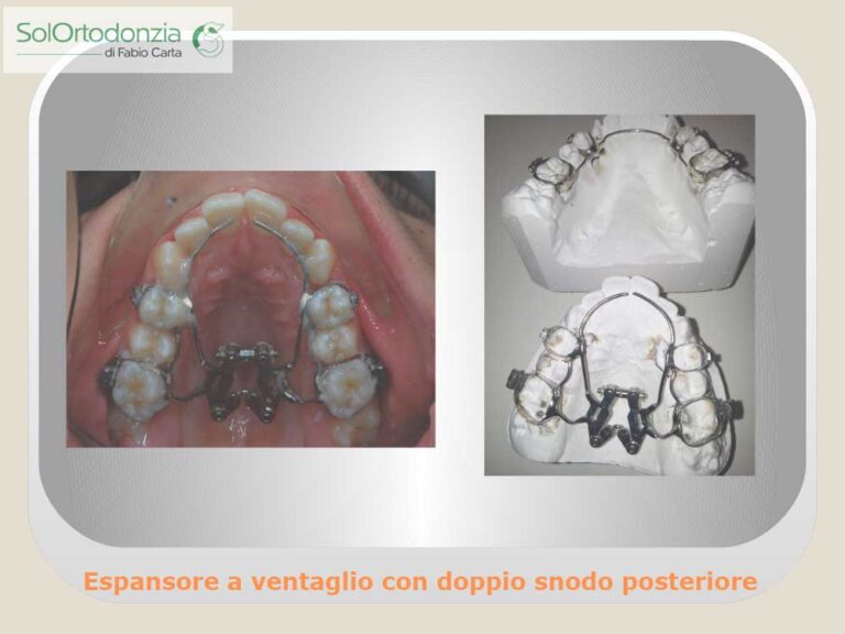 Dispositivi-fissi-10