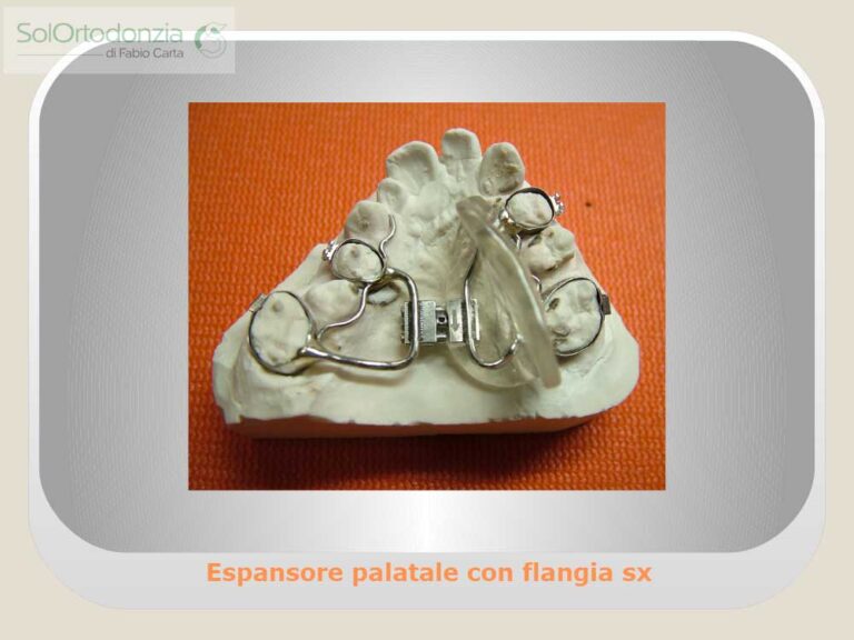 Dispositivi-fissi-11