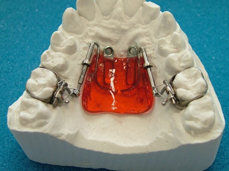 dispositivi fissi 13