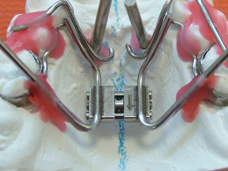 dispositivi fissi 15