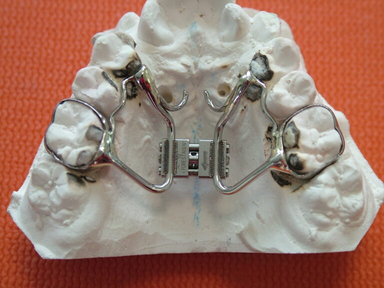 dispositivi fissi 17